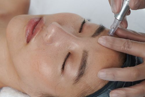 Pro Micro-needling